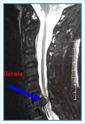 Columna Cervical - 3