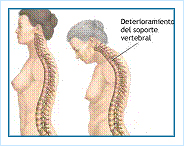 Alteraciones Metabolicas y Osteoporosis 1
